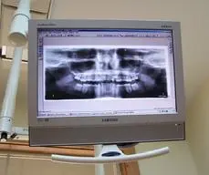 x-ray
